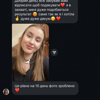 Збільшення губ
                    Косметолог Анна Вінниця