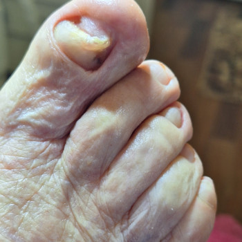 Це вже після зачистки н/п у пані 86р