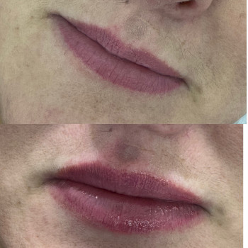 Натуральні губки, контурна пластика