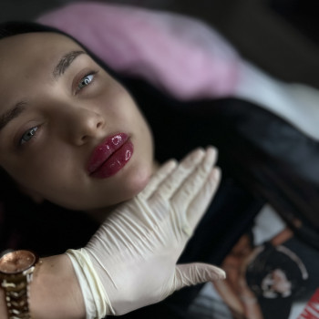 Контурна пластика губ + підборіддя