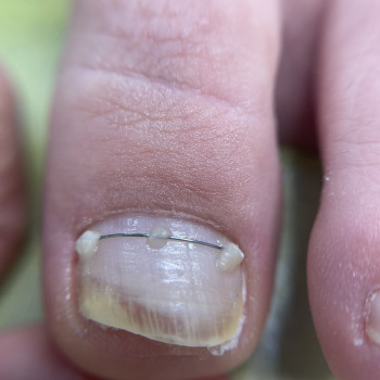 Алёна Пащина, Пирятин Фото - 5