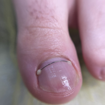 Алёна Пащина, Пирятин Фото - 16