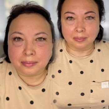 Анастасія Удянська, Бровари Фото - 6