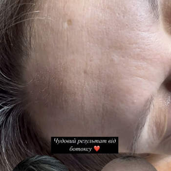 Екатерина Пинчук, Чернигов Фото - 10