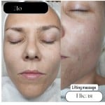 Комплекс рекомендований після пластичної хірургії (мікроструми+ліфтинг масаж обличчя+маска альгінатна) Косметолог Юлія Київ