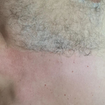 Оксана Фесенко, Київ Фото - 5