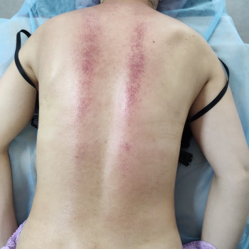 Масаж тіла
                    Масажист  Самбір