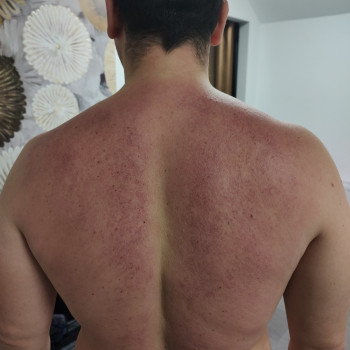 Масаж тіла
                    Масажист  Самбір