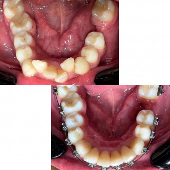 One Dental Clinic, Киев Фото - 5