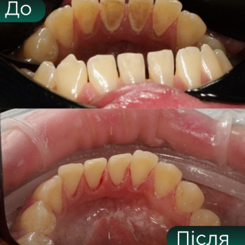 Ukrainian Dentist Club, Киев Фото - 5