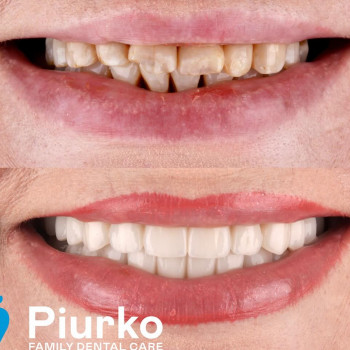 Piurko, Киев Фото - 5