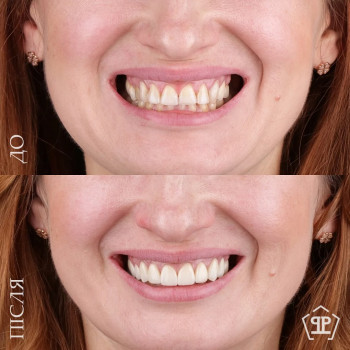 Реферта, Київ Фото - 5