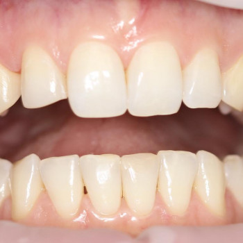 Andreev Dental Clinic, Киев Фото - 5