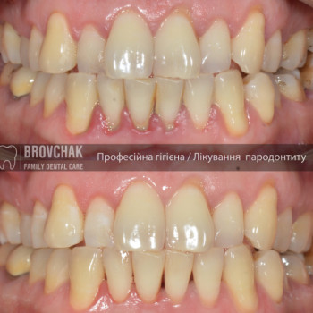 Brovchak, Київ Фото - 5