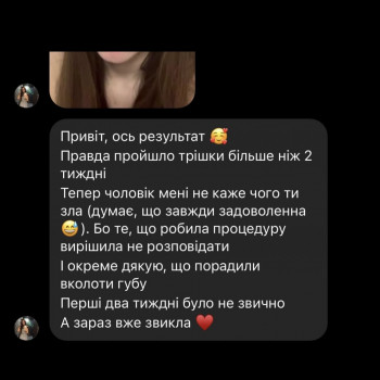 Анна Сломинская, Винница Фото - 7