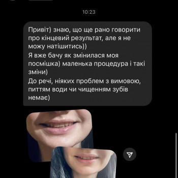 Анна Сломинская, Винница Фото - 11