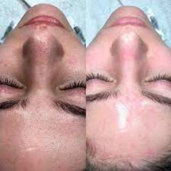 Светлана Еременко, Запорожье Фото - 2