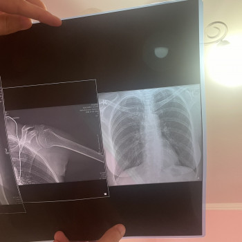 Дмитро Саєнко, Ивано-Франковск Фото - 5