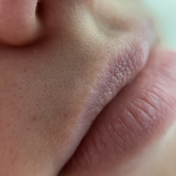 Депіляція обличчя
                    Бровіст Иванна Кропивницький