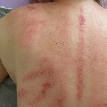 Реабилитация после Covid.
 
 
 