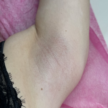 Діана Радиш, Черновцы Фото - 6