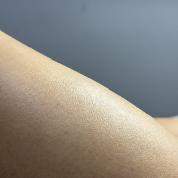 Діана Радиш, Черновцы Фото - 7