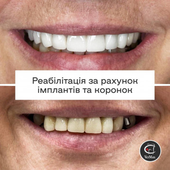 VerMax, Київ Фото - 5