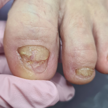 Тетяна Петрова, Чорноморськ Фото - 13