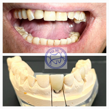 Усі 32, Київ Фото - 5