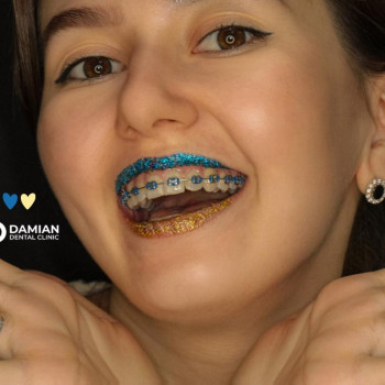 Damian, Киев Фото - 5