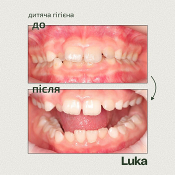 Luka Dent, Київ Фото - 5