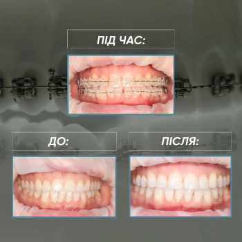 Crystal Dent, Київ Фото - 5