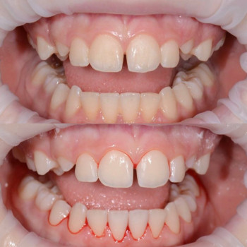 illi Dental, Київ Фото - 5