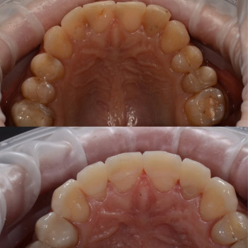 illi Dental, Київ Фото - 6