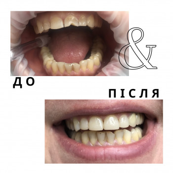 Слален, Київ Фото - 6