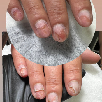 Подология
                    Мастер маникюра Наталья Кременчуг