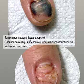 Подология
                    Мастер маникюра Наталья Кременчуг