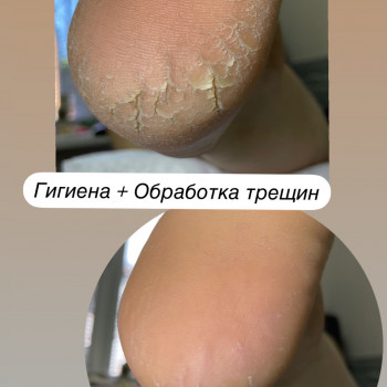 Обработка трещин