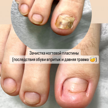 Обработка ногтей