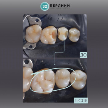 32 Перлини, Киев Фото - 5