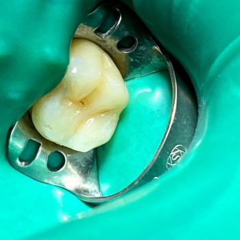 Before & After, Київ Фото - 5