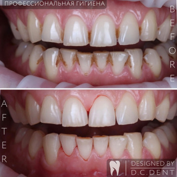 D.C. Dent, Киев Фото - 5