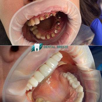 Dental Breeze, Київ Фото - 5