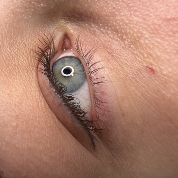 Загоєна класична стрілка