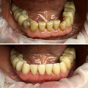 Ave Dent, Киев Фото - 5