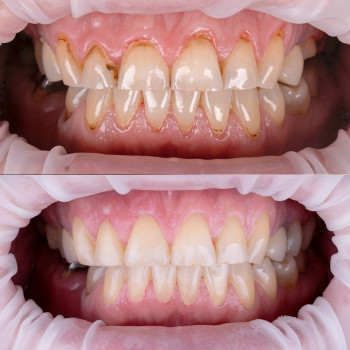 Твій стоматолог, Киев Фото - 5