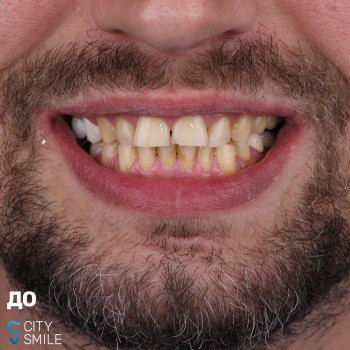 City Smile, Киев Фото - 5