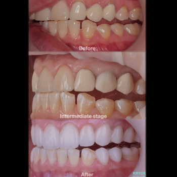 Kryuk, Вінниця Фото - 5