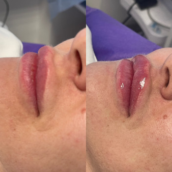 Наталія Книженко, Київ Фото - 15