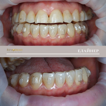 RevoDent, Вінниця Фото - 5